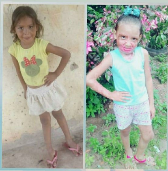 Hanna no antes e depois do ataque